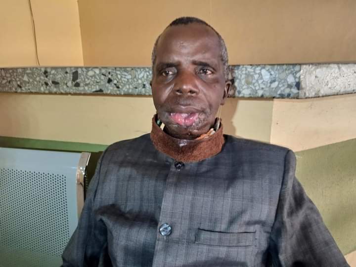 Man Tells Osun Panel: I Lost My Lower Lip, Jaw, Teeth To Police Brutality, Today I'm Permanently Disfigured