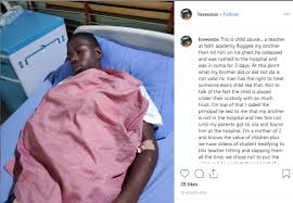 Student Beats Teacher Into Coma In Ogun
