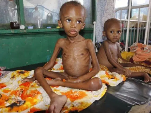 Malnutrition: UNICEF Stresses Need For Urgent, Sustained Investment In Child Nutrition, Survival, Well-being