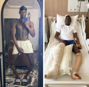 After Successful First Stage Surgery to Correct His Bow-leg, Baddy of Lagos Returns To Nigeria